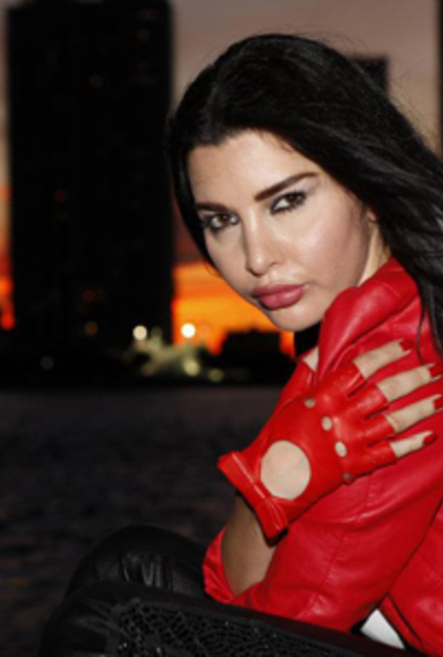 لاميتا فرنجيه بعد عمليات التجميل