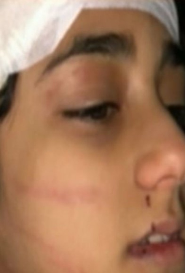 والد مايا بخش يروي تفاصيل إصابة ابنته في مزرعة ذهبان