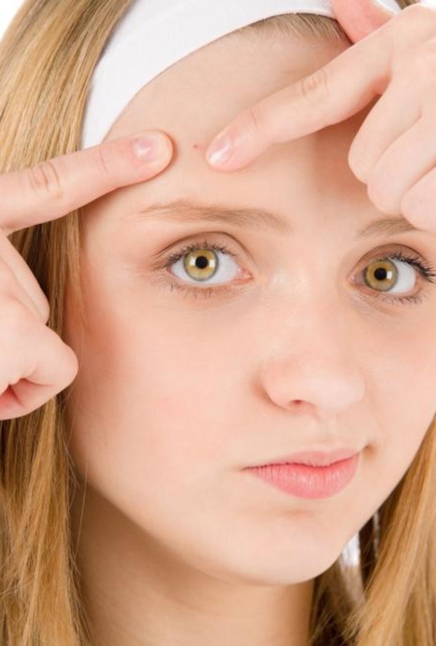 حب الشباب سبب ندوب البشرة 