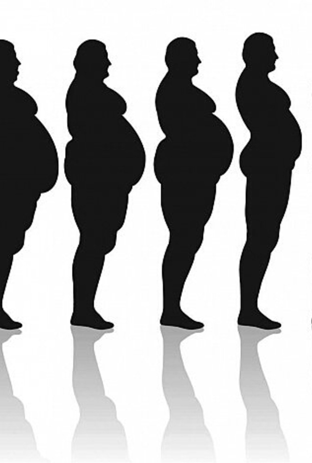 السمنة في تزايد مستمر