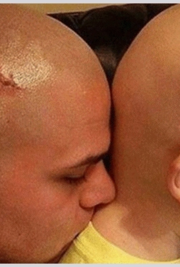 اب يحلق راسه تضامنا مع ابنه مريض السرطان