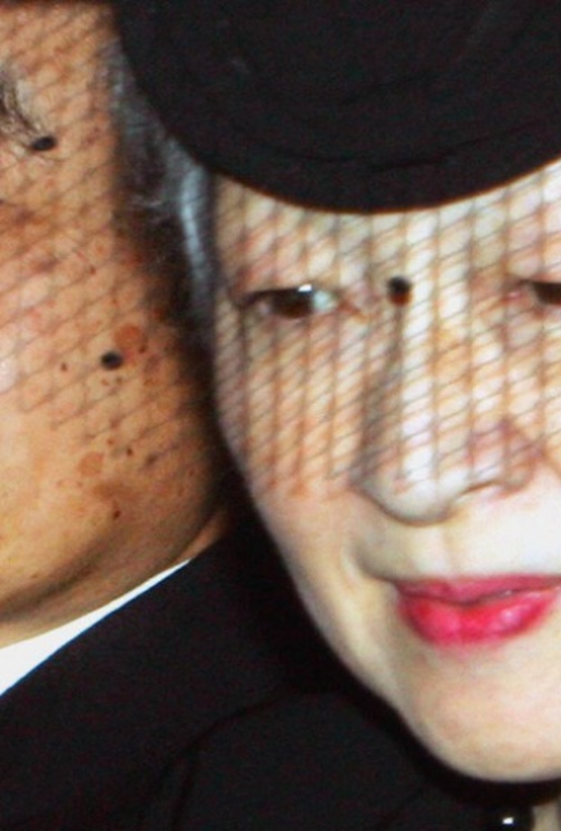 إمبراطور اليابان يعاني من مشاكل صحية كبيرة