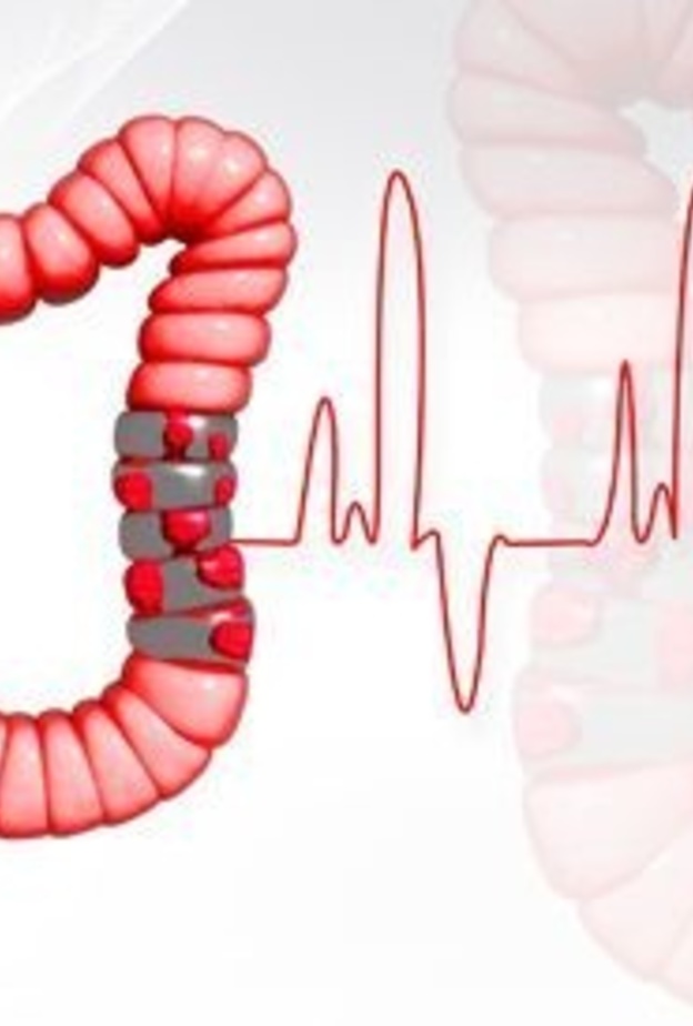 سرطان القولون