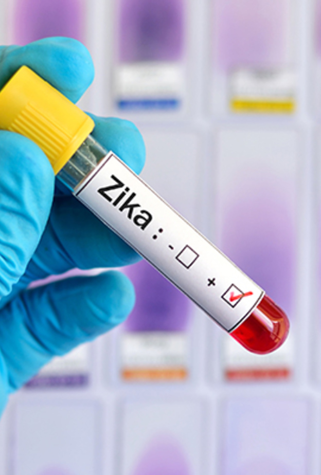 فيروس زيكا