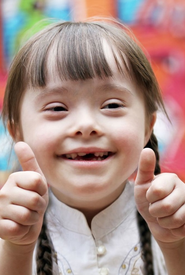 المصابين بمتلازمة داون لاتفارقهم الابتسامة ابدا 