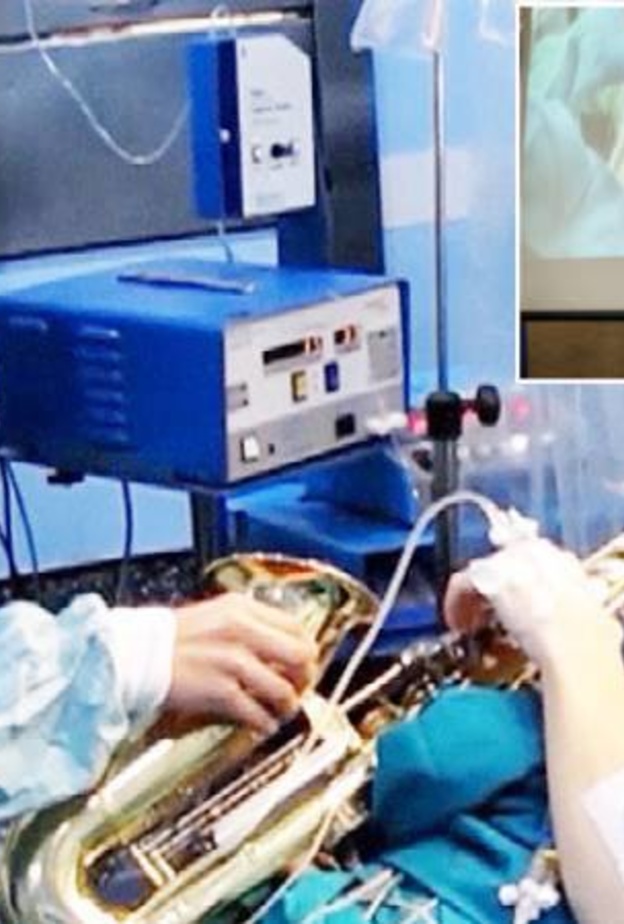 بالفيديو مريض يعزف على آلة موسيقية أثناء إزالة ورم من دماغه