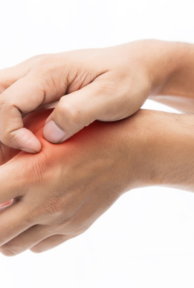 طرق طبيعية لعلاج الحروق الخفيفة في المنزل