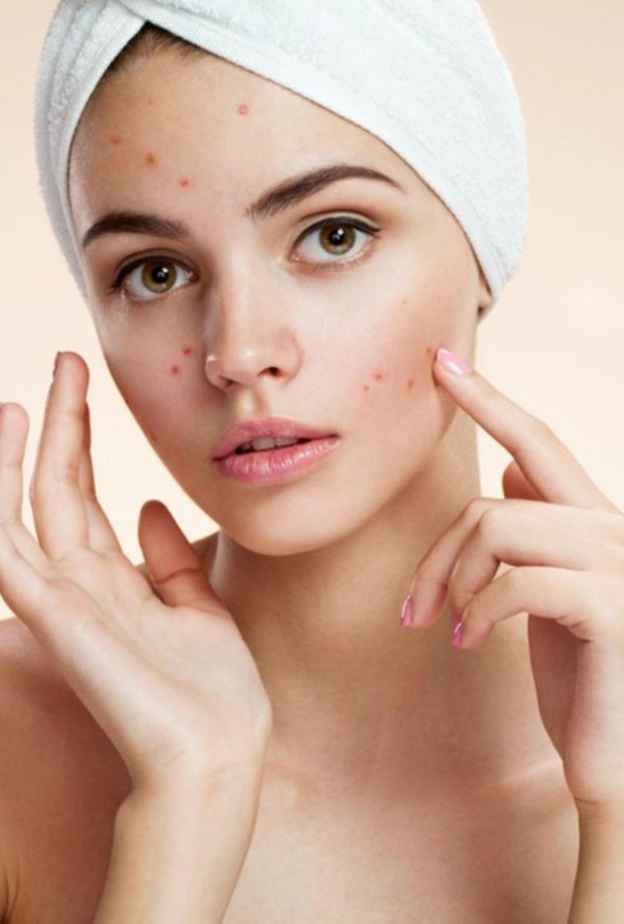 تهيج الجلد والبقع الحمراء به من أعراض الصدفية