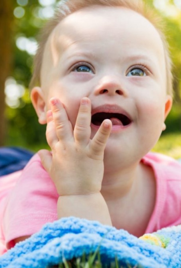 صفات تؤكد ان الطفل منغولي