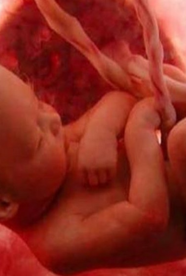 10اسباب لضعف حركة الجنين