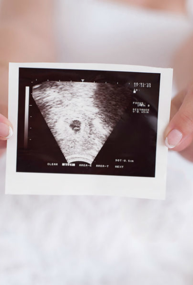 يمكن قياس نبض الجنين من الاسبوع 8 من الحمل