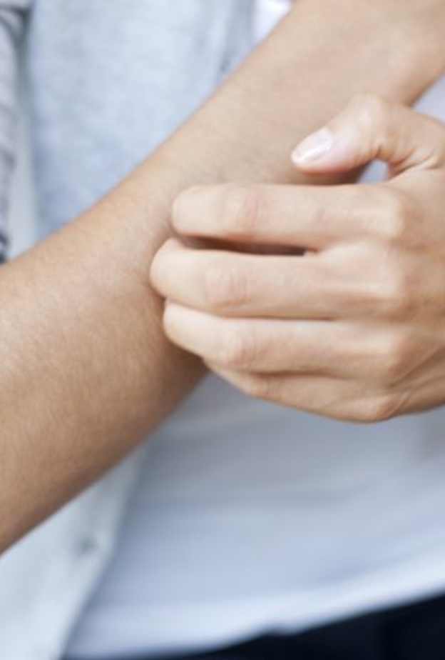  الطفح الجلدي يمكن علاجه بالأشعة الفوق بنفسجية