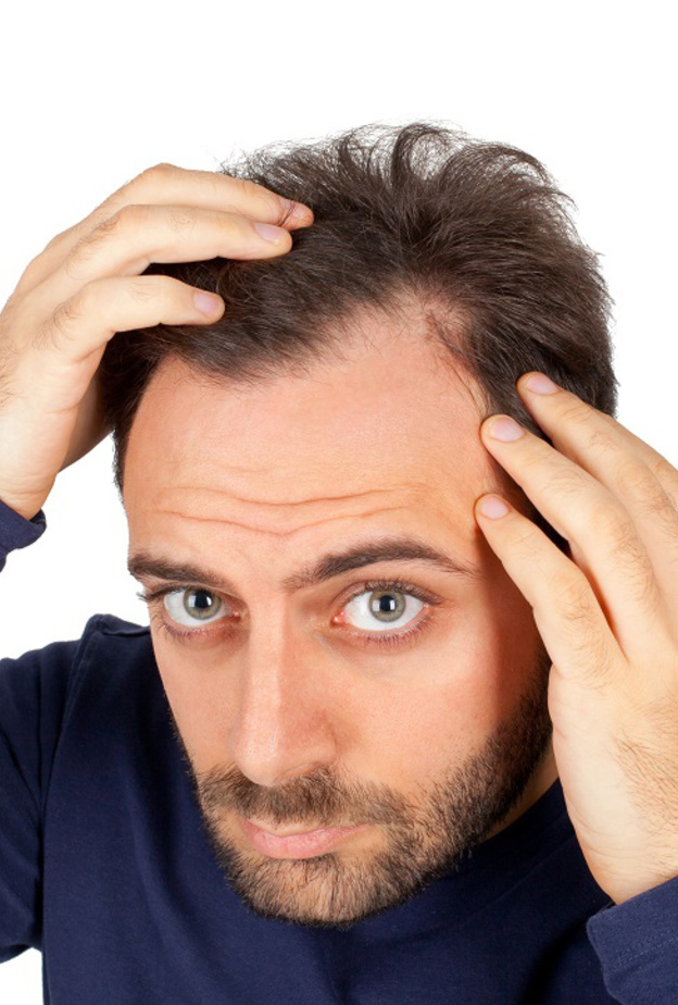 زراعة الشعر الطريقة العلاجية التي غالبا ما يلجأ إليها من يعانون من الصلع