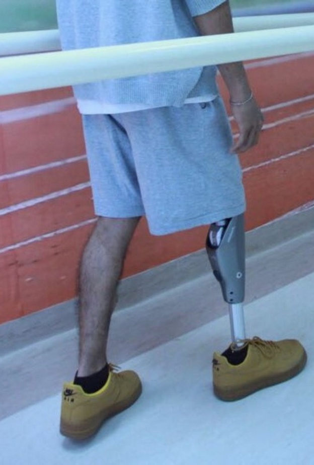 الركبة الالكترونية أحدث تقنيات التأهيل في السعودية