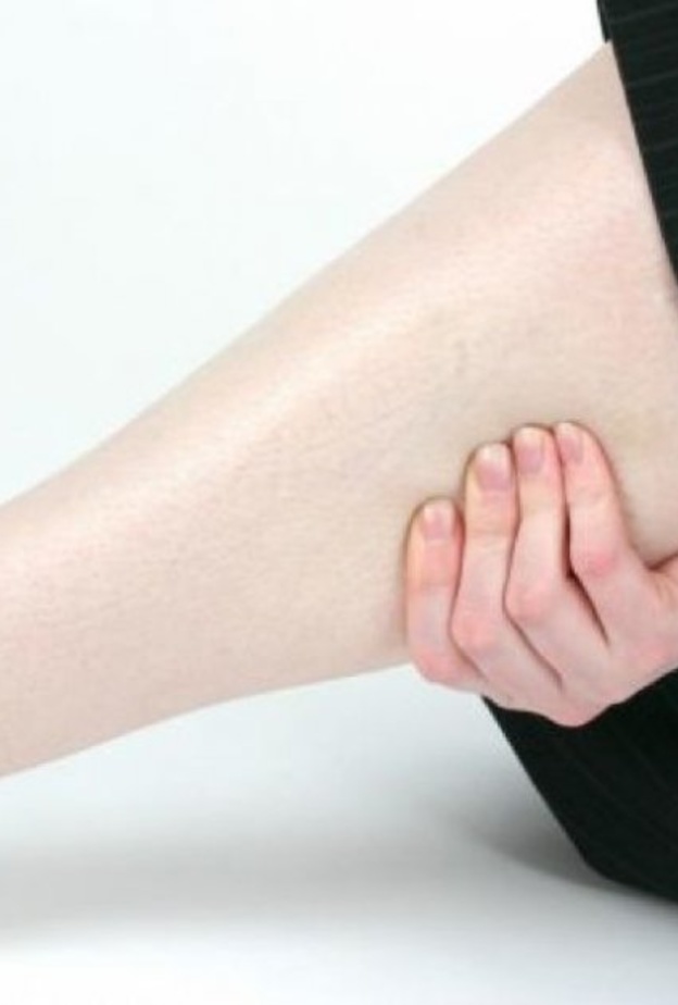 ألم الساق من أعراض الدوالي