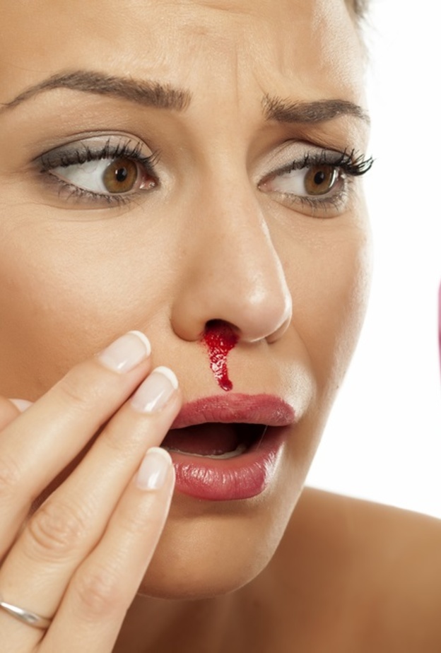 اسباب نزيف الانف المفاجئ