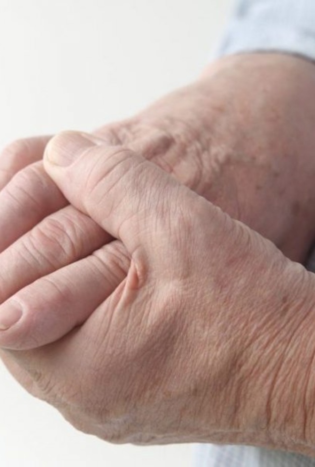 علاج التهاب المفاصل الروماتويدي