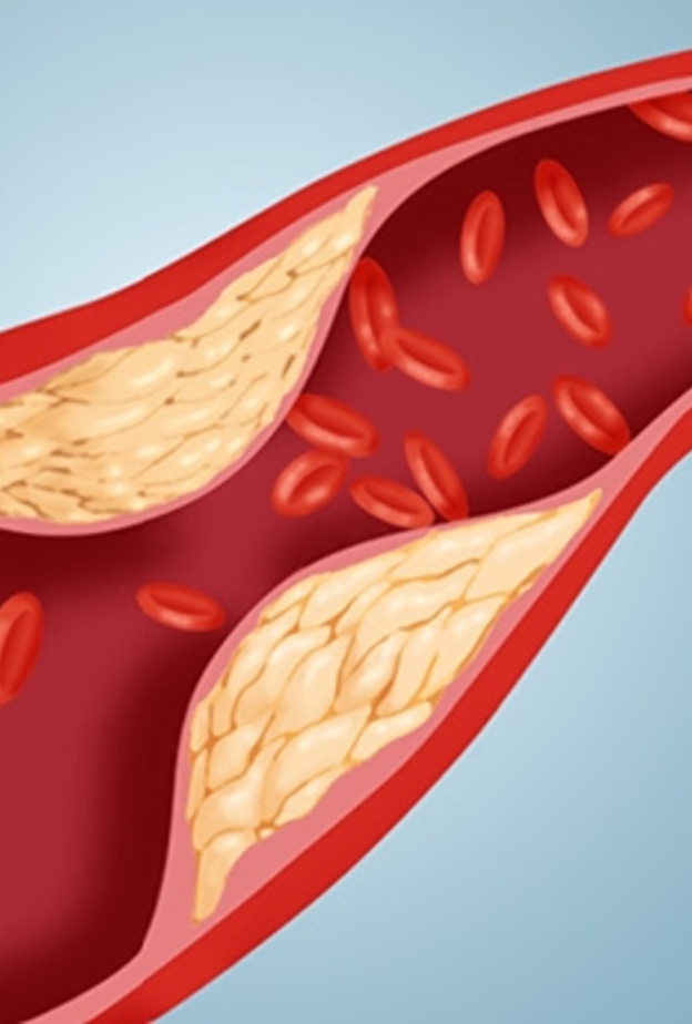 الخضروات الطازجة تحد من تأثير الكولسترول الضار