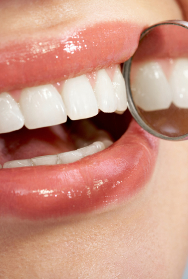 علاج تسوس الأسنان الأمامية بالفلورايد الموضعي