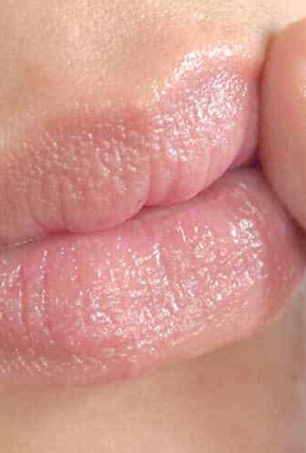 حبوب بعد السخونة سببها فايروسي