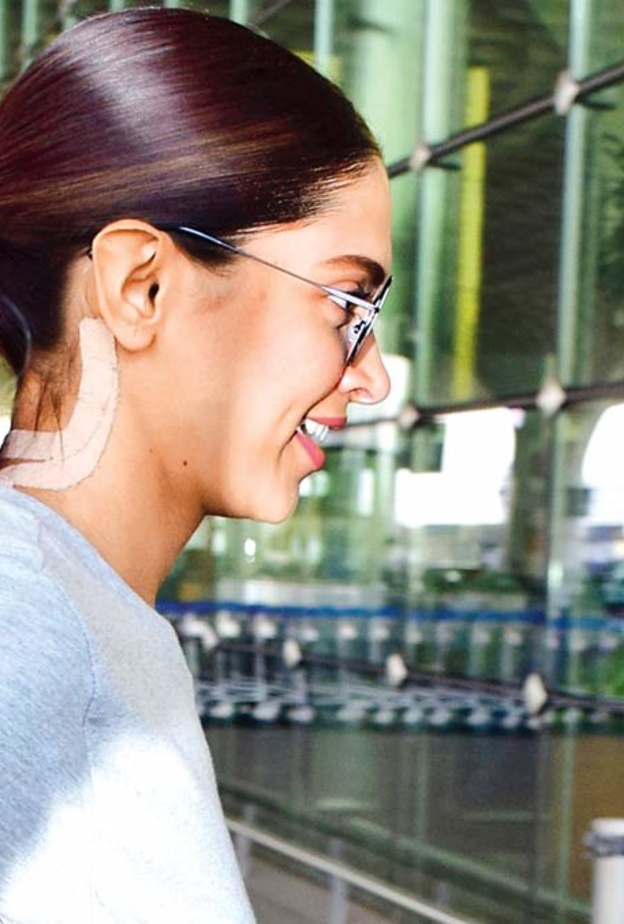 ديبيكا بادوكون تضع ضمادة على عنقها