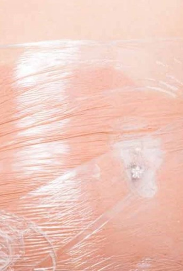 اللف التنحيفي يتم بدهن مناطق معينة من الجسم بالزيوت ثم لفها بالورق البلاستيك