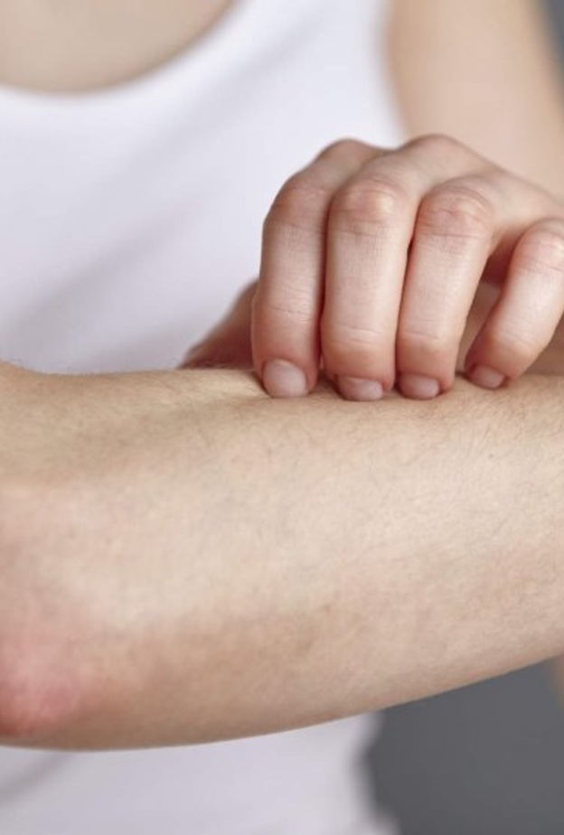 زيادة الامراض الجلدية بسبب تغير المناخ 