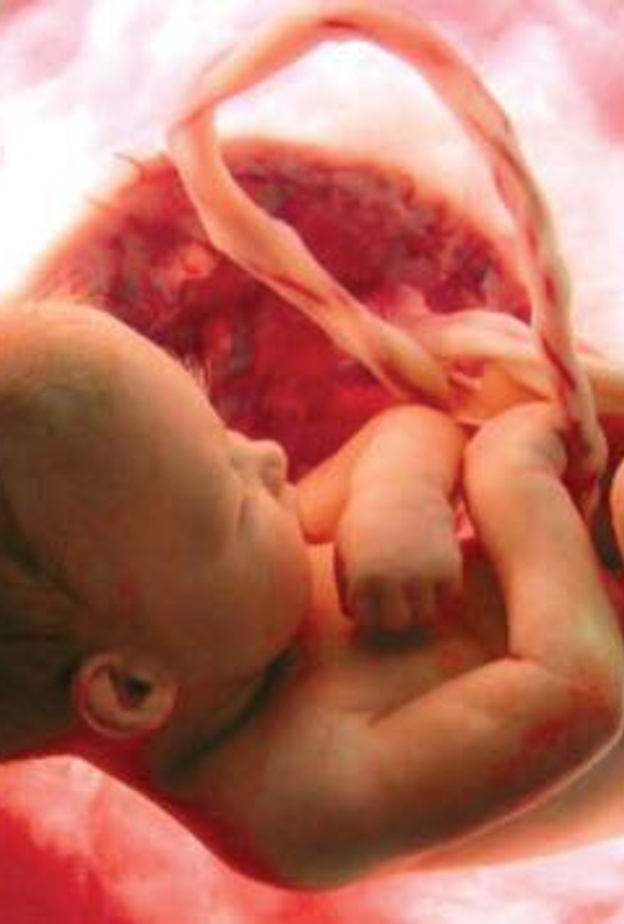 نصائح علمية لحماية الجنين من التشوهات الخلقية