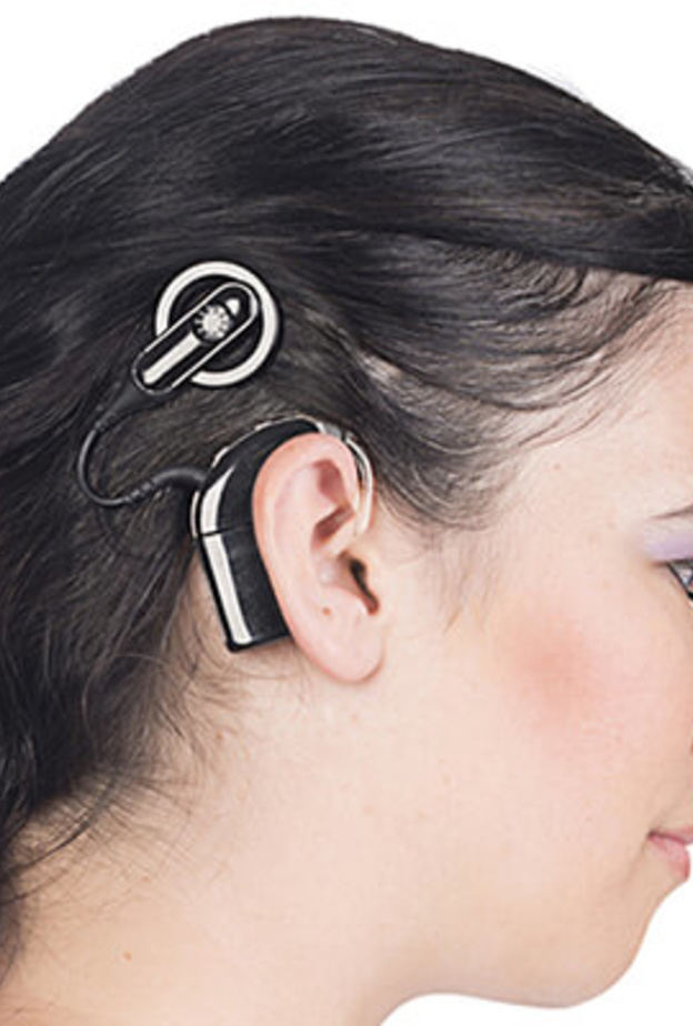  زراعة القوقعة يجب أن يكون بعدها برنامج تأهيل سمعي