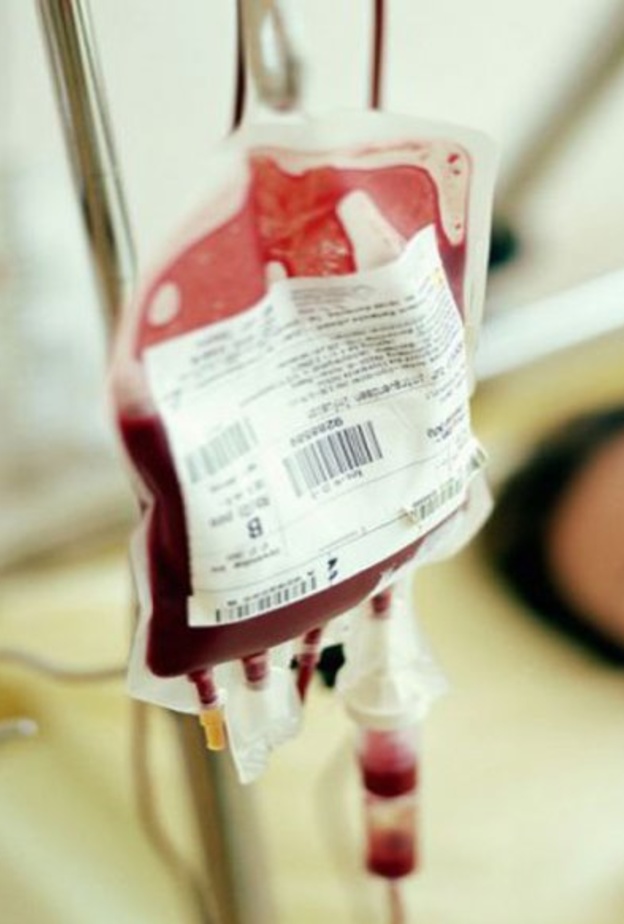 نقل الدم أبرز علاجات نقص الصفائح الدموية