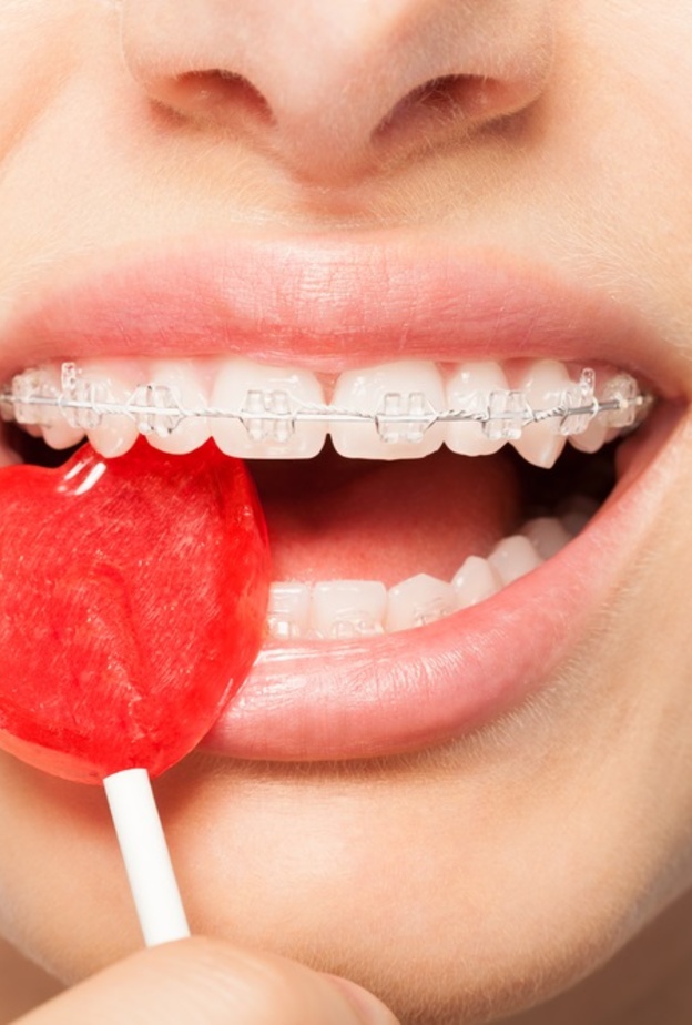 تجنب مضع الاطعمة الصلبة لمنع تكسر وضعف الاسنان