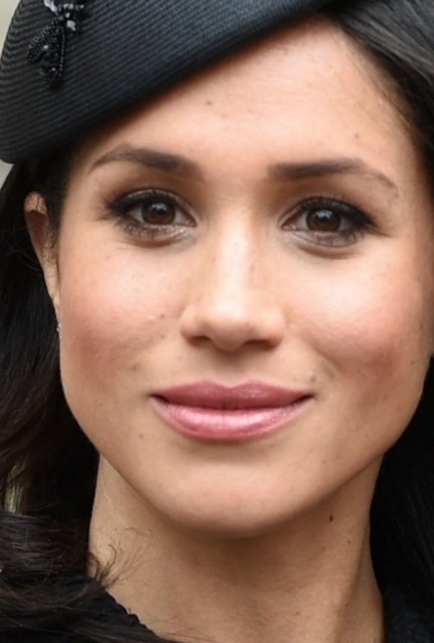 ميغان ماركل وعمليات التجميل 2018