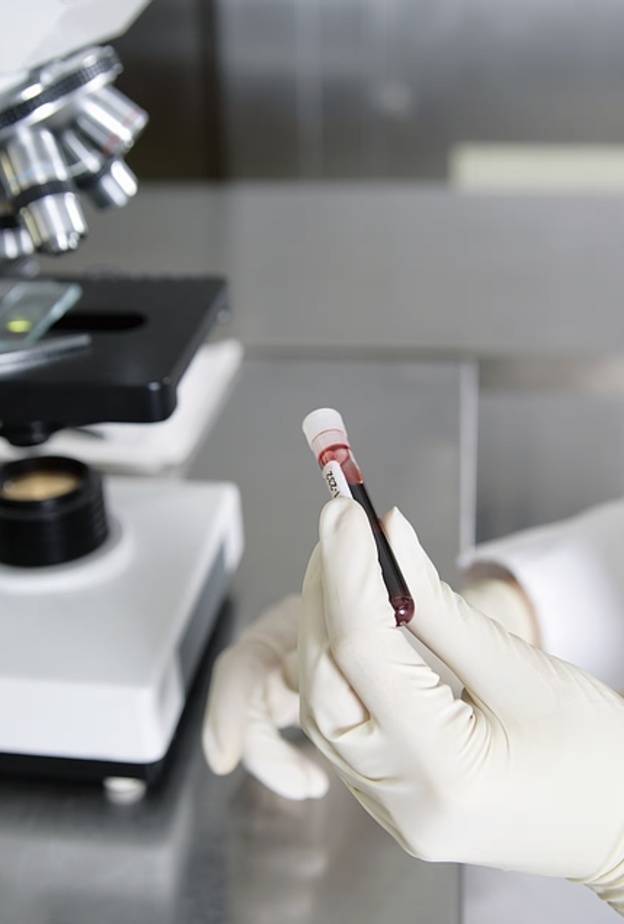 تحاليل الدم تختلف بإختلاف النتائج