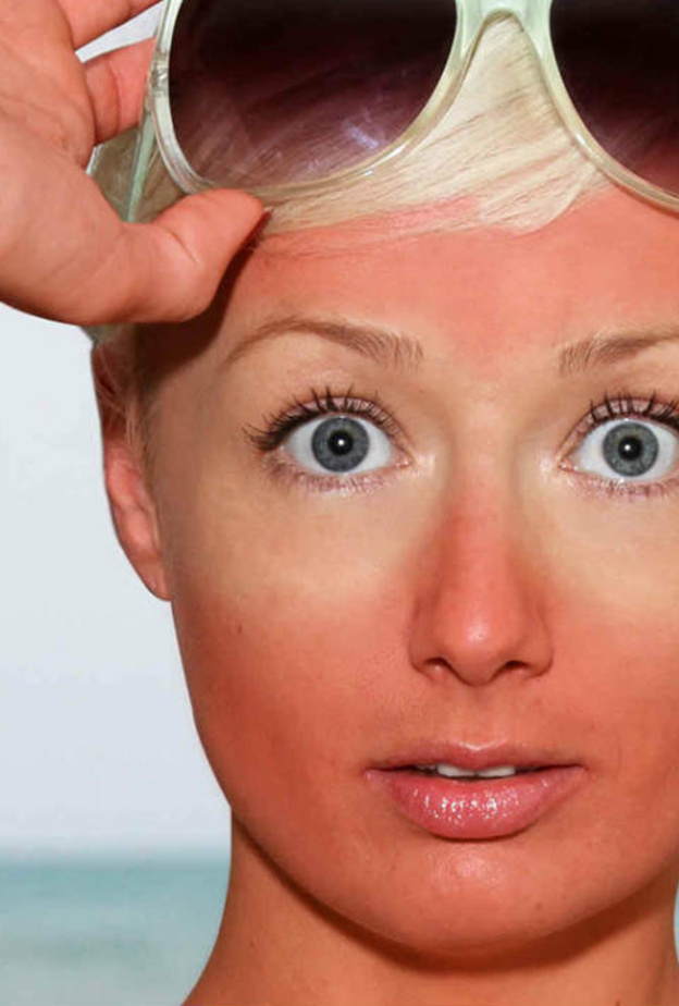 كثرة التعرض للشمس يسبب جفاف وتغير لون البشرة