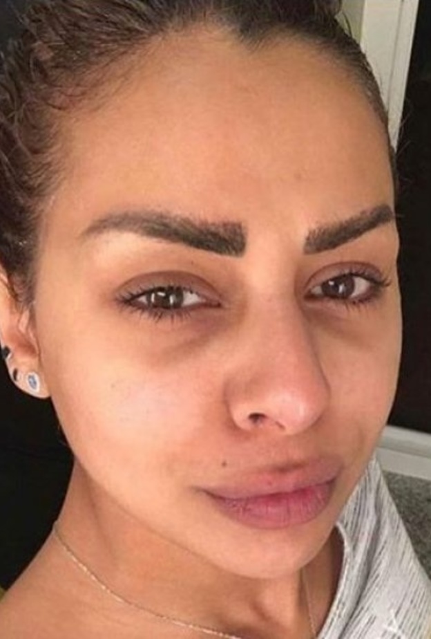 هند البلوشي تصاب بمرض يحير الاطباء