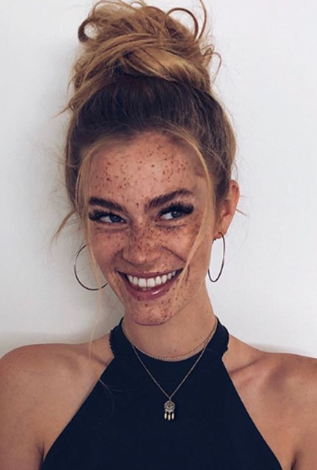 سوانتى بولينا تلقب بملكة جمال النمش