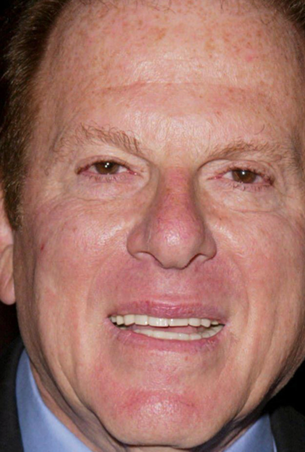 أرنولد كوبيلسون 