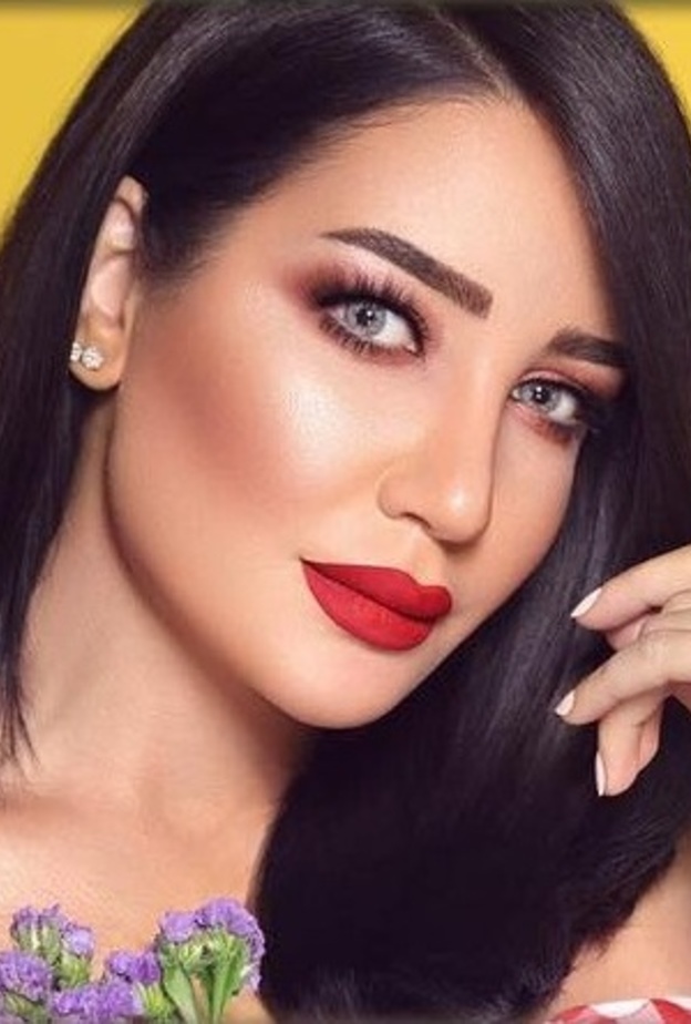 أمل العنبري قبل ازالة حقن الفيلر من وجهها