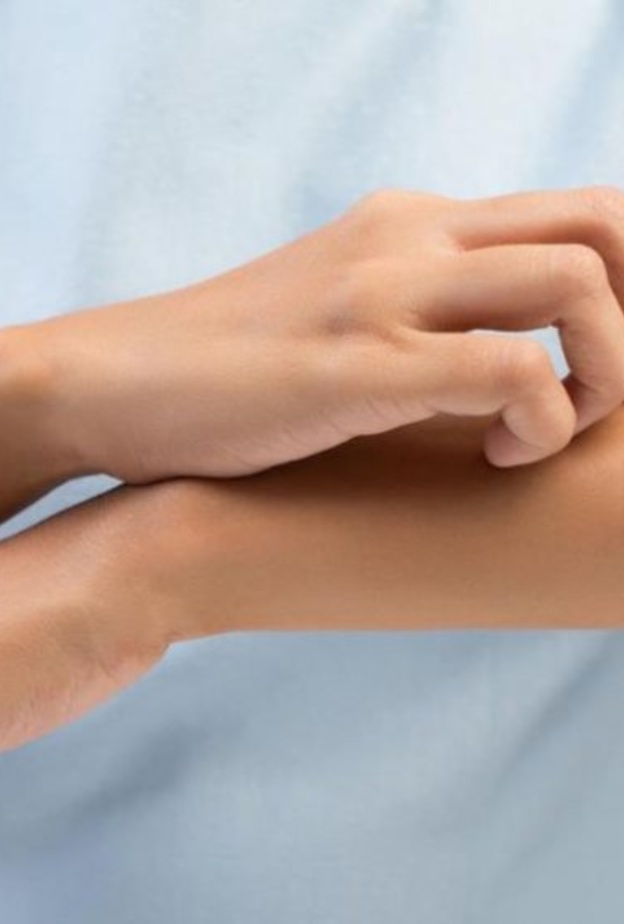  الحمى القرمزية تسبب طفح جلدي وحكة