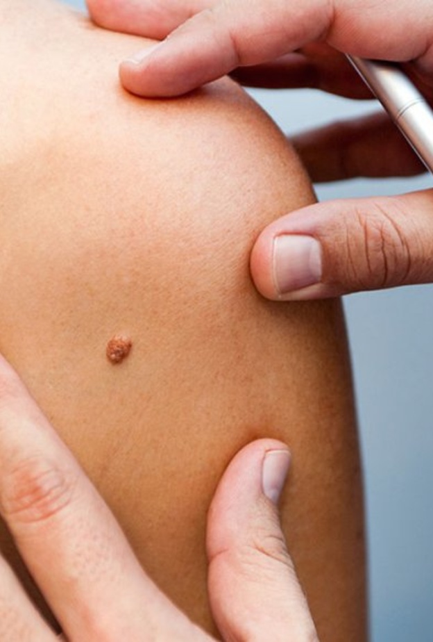 يختلف نوع الثالول حسب مكان الإصابة