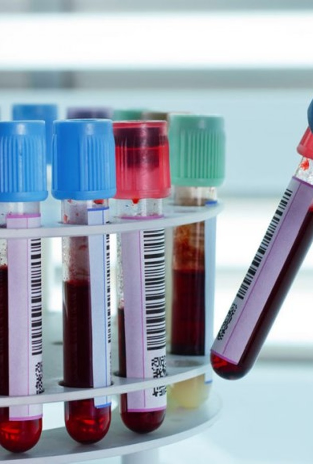 فقر الدم الحديث هو نقص فيتامين ب12