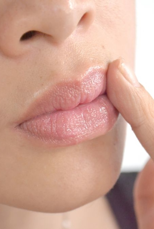 أسباب تشققات زوايا فم العروس وطرق علاجها