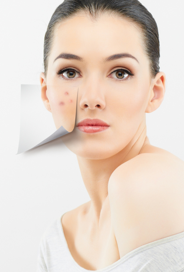 تعرفي على طرق علاج حب الشباب بماء الورد