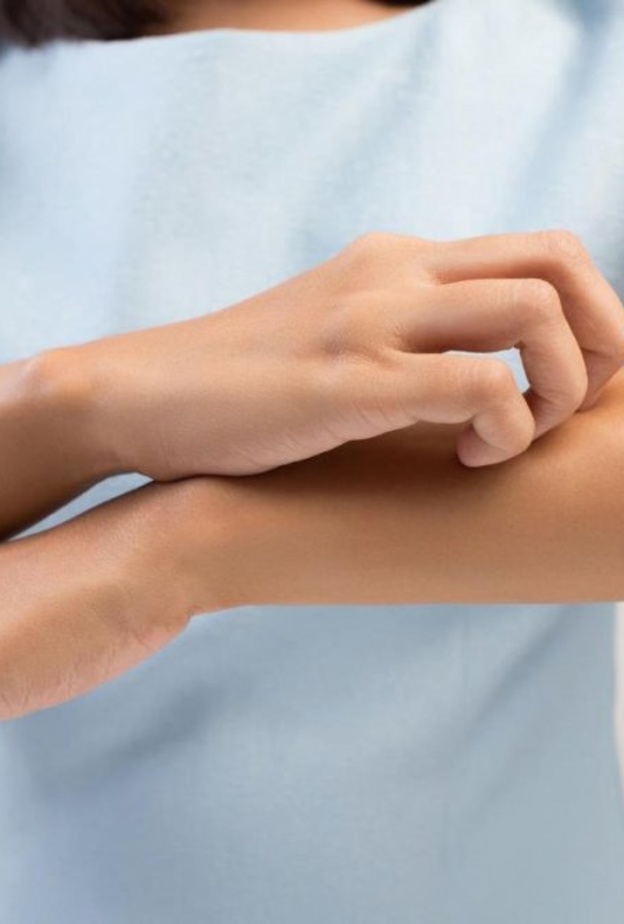 مرض الأكزيما يسبب حكة جلدية