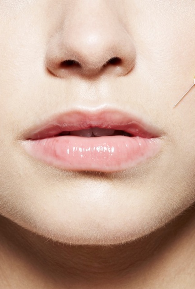 هل حقن الفيلر مؤلمة ؟