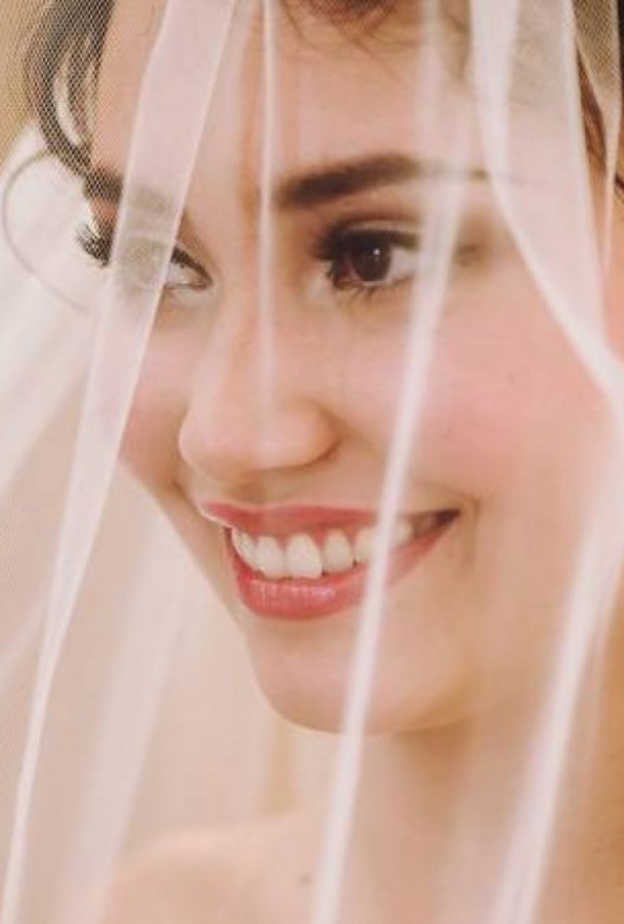 احرصي على اتباع حمية غذائية متوازنة تتضمن مصادر غنية بعنصر الحديد وفيتامين B12 والفولات