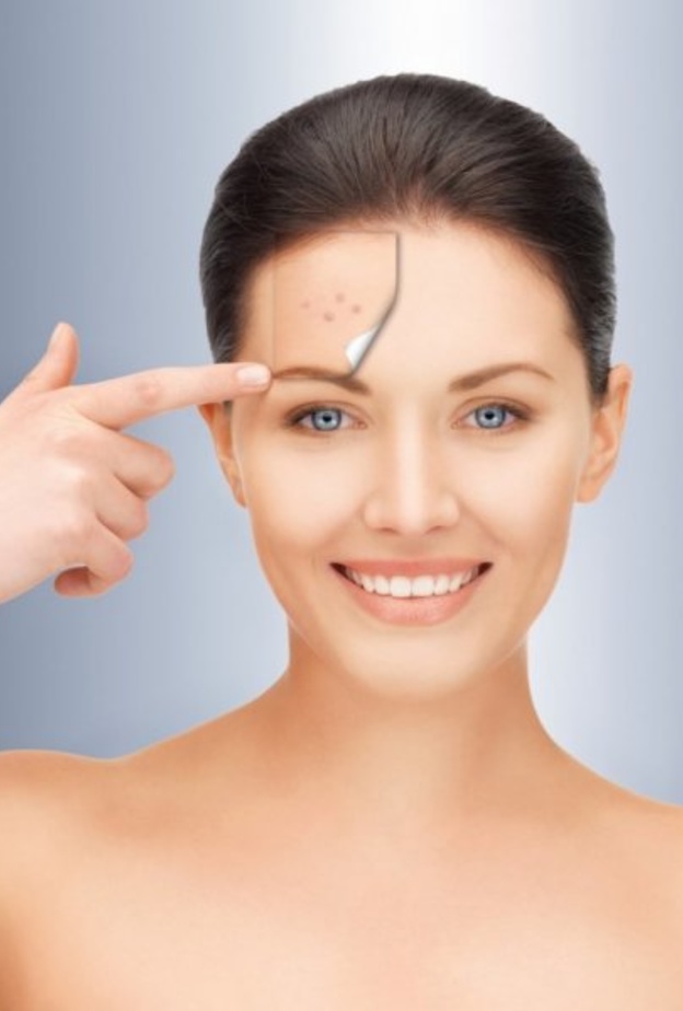 لا تتناسب جلسات تقشير البشرة بالليزر مع البشرة الداكنة