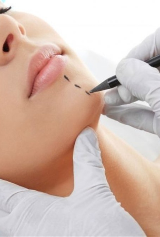 كيف تتم عملية تصغير الذقن؟