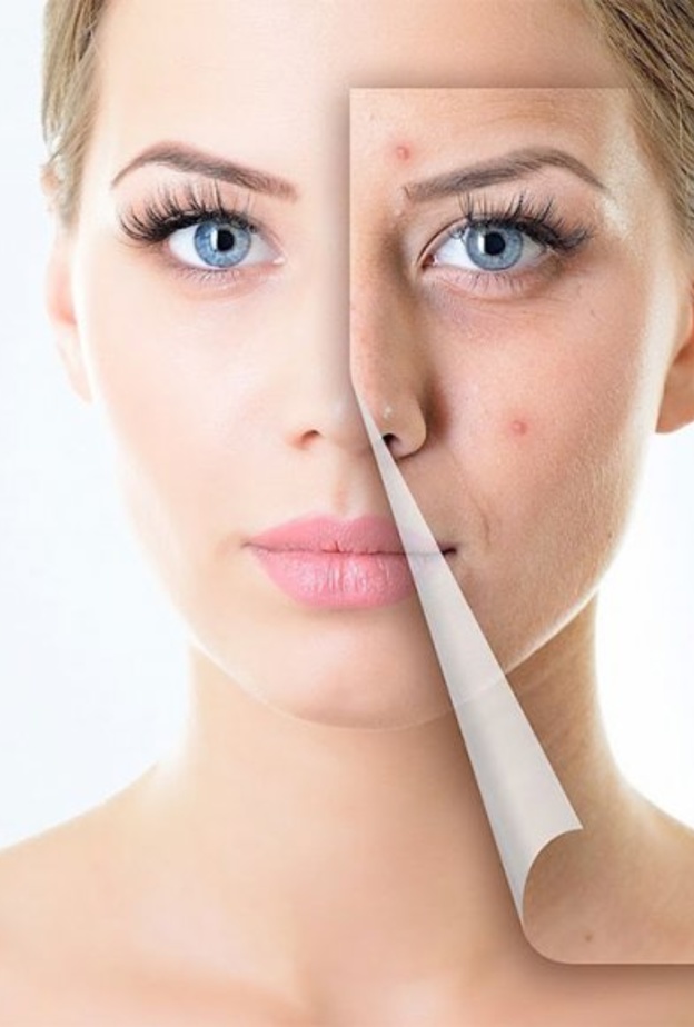 اهم فوائد واضرار عسل الشفلح للبشرة