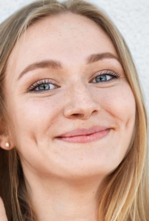 احصلي على غمازات طبيعية ودائمة في الخدين من خلال عملية غمازات الخدين